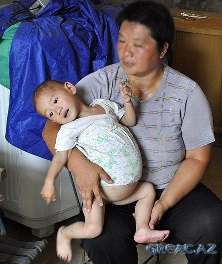 Беременный китайский ребенок
