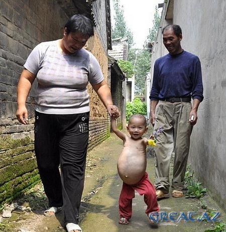 Беременный китайский ребенок