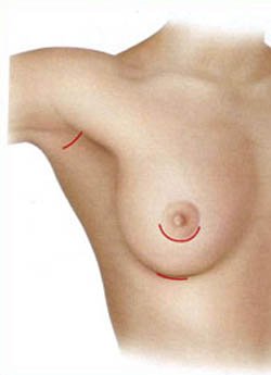 Как увеличить грудь?