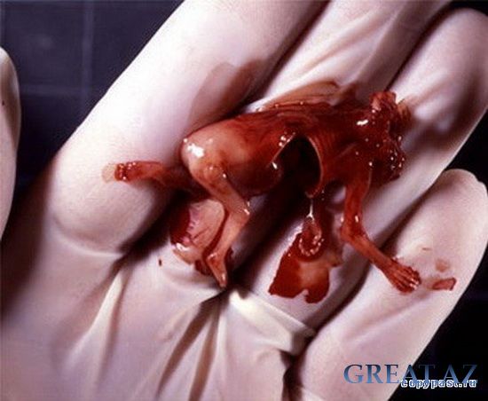 Результаты абортов