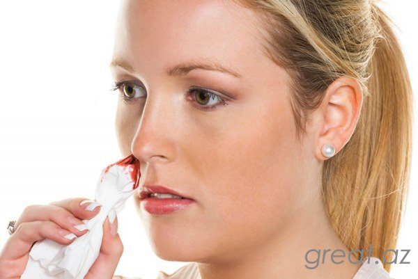 6 приемов быстро остановить кровотечение из носа