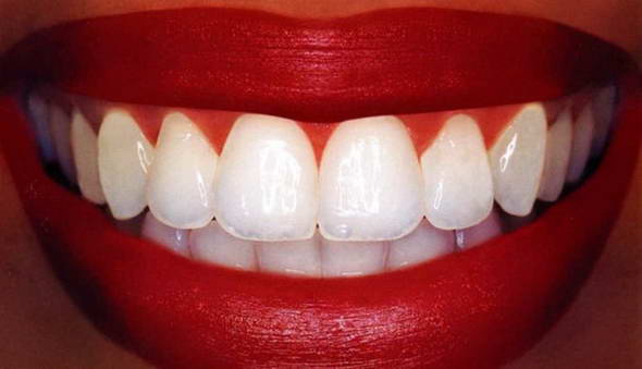 Как сделать зубы белыми в домашних условиях