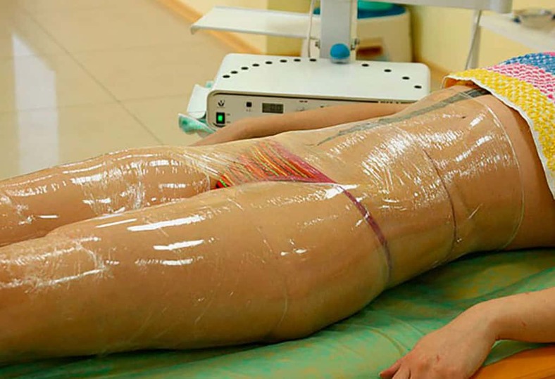 Эффективные домашние обертывания для похудения живота: Практическое руководство