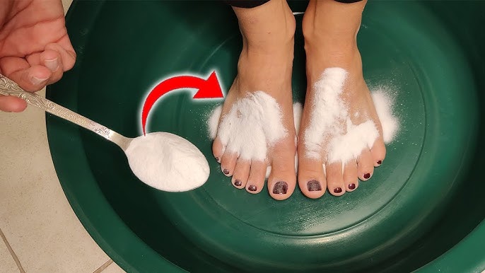 Как вылечить трещины на пятках в домашних условиях содой: эффективные методы