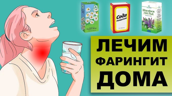 Чем лечить ангину в домашних условиях быстро и эффективно