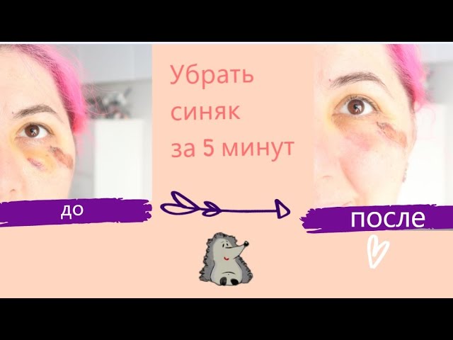 Чем мазать синяки чтобы они быстрее желтели и проходили