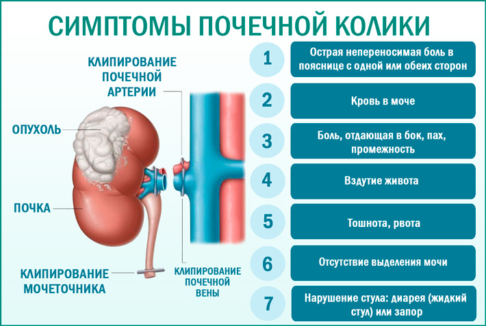 Что делать, если болят почки в домашних условиях: первая помощь